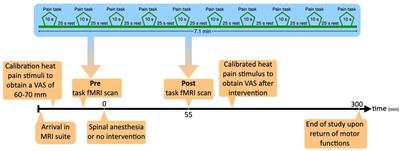 Effect of spinal anesthesia-induced deafferentation on pain processing in healthy male volunteers: A task-related fMRI study